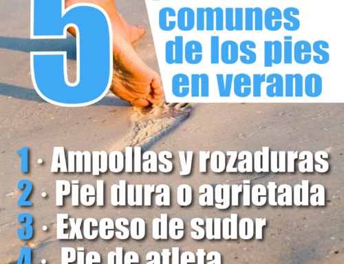5 problemas comunes de los pies en verano